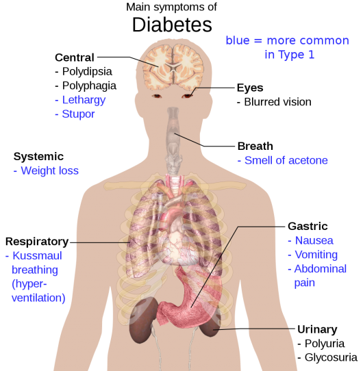 image of Diabetes